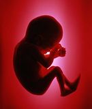 Fetus.jpg Fetus image by TrustyShellback
