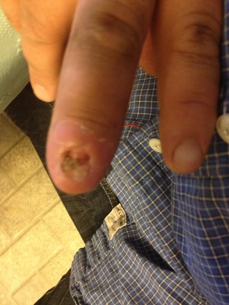 Farm safety - Homesteading Questions